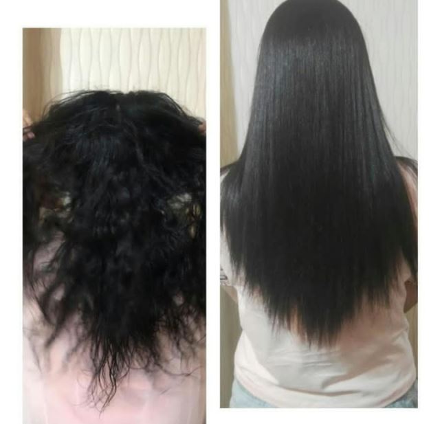 قبل و بعداز کراتینه