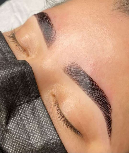 ترمیم و تقویت ابرو در تهران