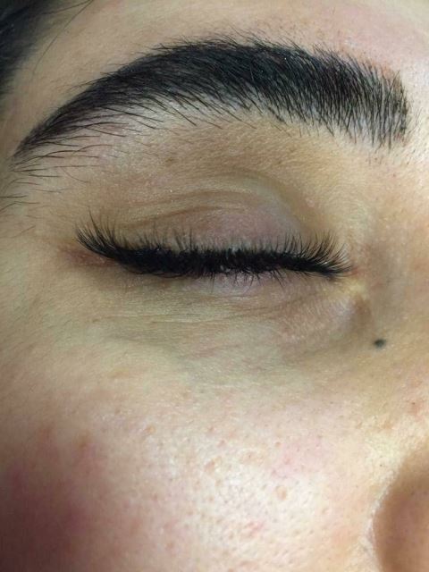 ترمیم و تقویت ابرو در تهران