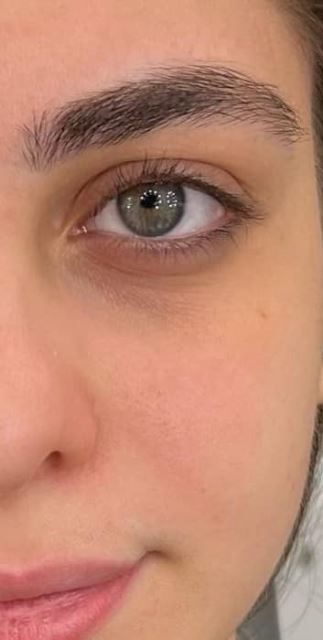 تقویت ابرو با جدید ترین روش