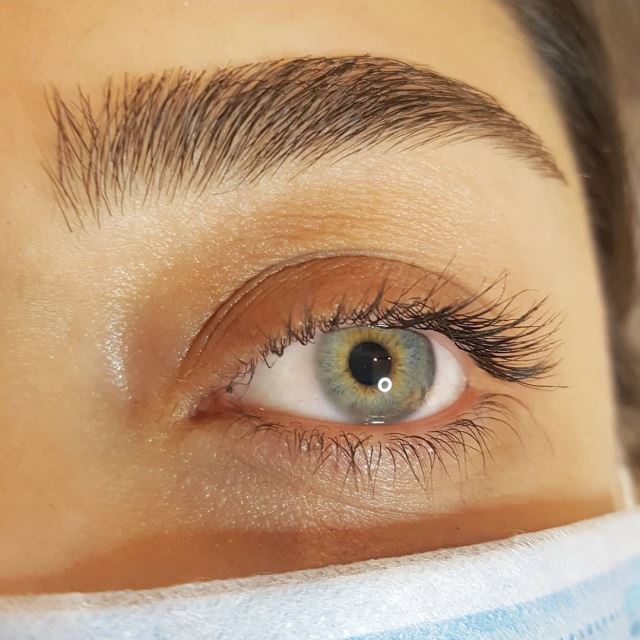 ترمیم و تقویت ابرو در تهران