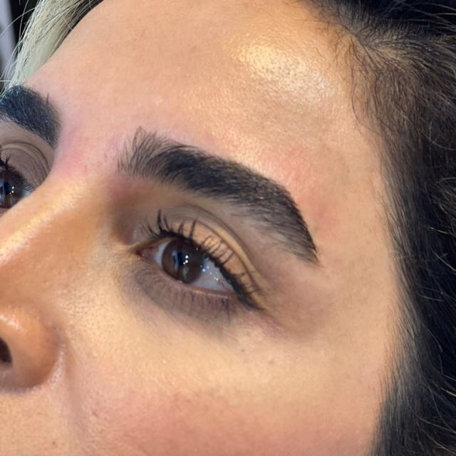 ترمیم و تقویت ابرو در تهران