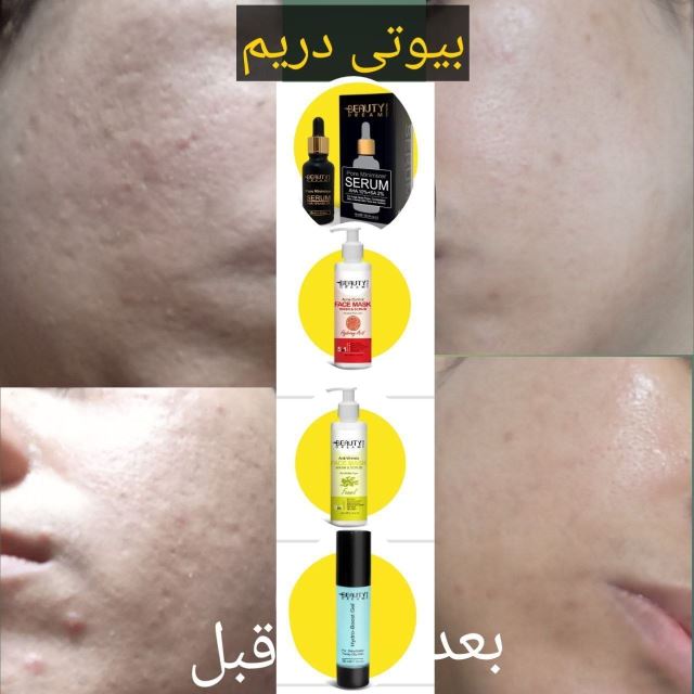 درمدت تقریبا دوهفته مصرف اینقدر پوستشون تغییر کرده عالی شده مشکلات: جوش . منافذ باز . تیرگی  ودهیدراته بودن . لک جای جوش
