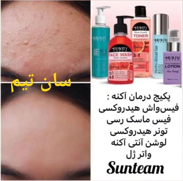 پکیج درمان آکنه 