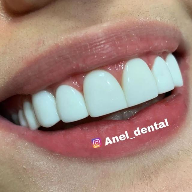 دندانپزشکی در تهرانپارس