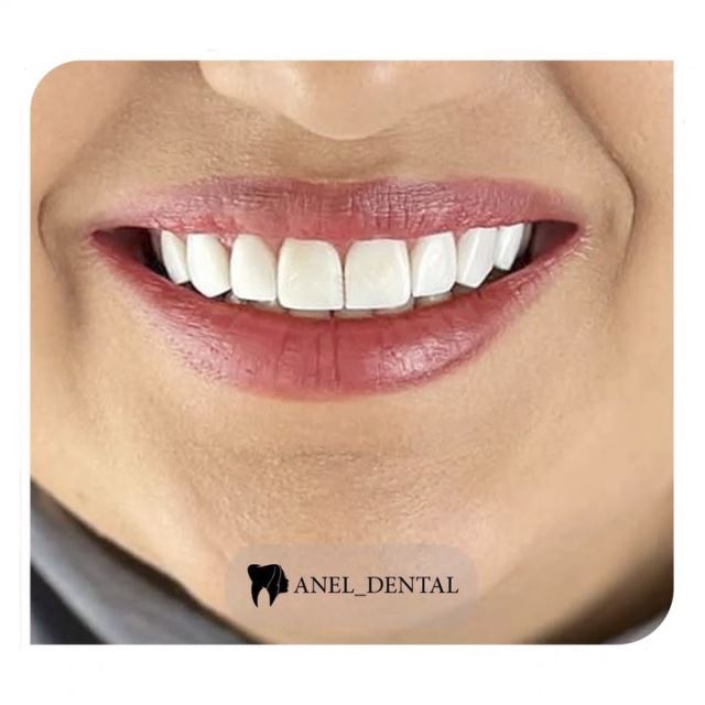 دندانپزشکی ارزان تهرانپارس