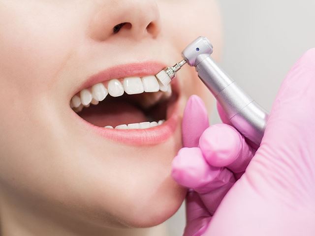 جرمگیری تخصصی 