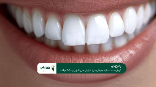 کامپوزیت لب شیشه ای 