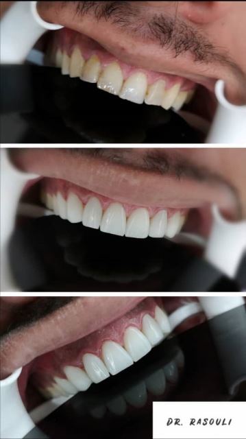 دندان