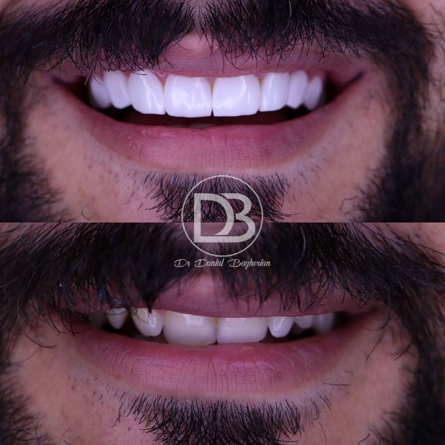 لمینت در شاهین شهر