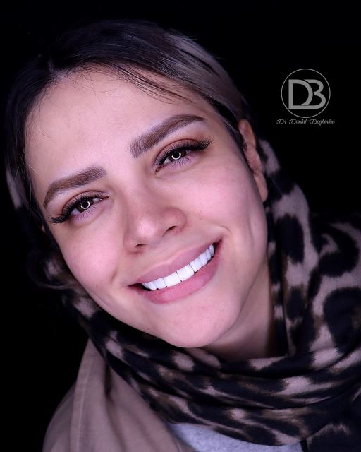 لمینت در شاهین شهر