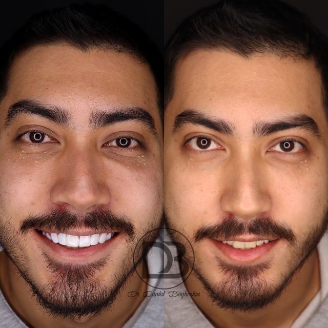 دندانپزشک زیبایی در شاهین شهر