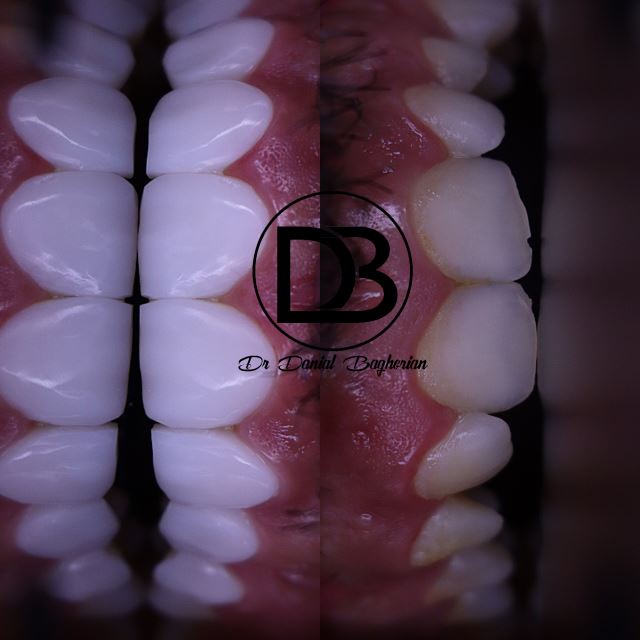 کامپوزیت قسطی در اصفهان