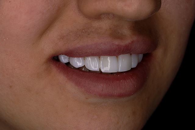 بهترین نوع لمینت چیست