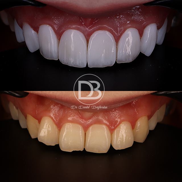 کامپوزیت قسطی در اصفهان