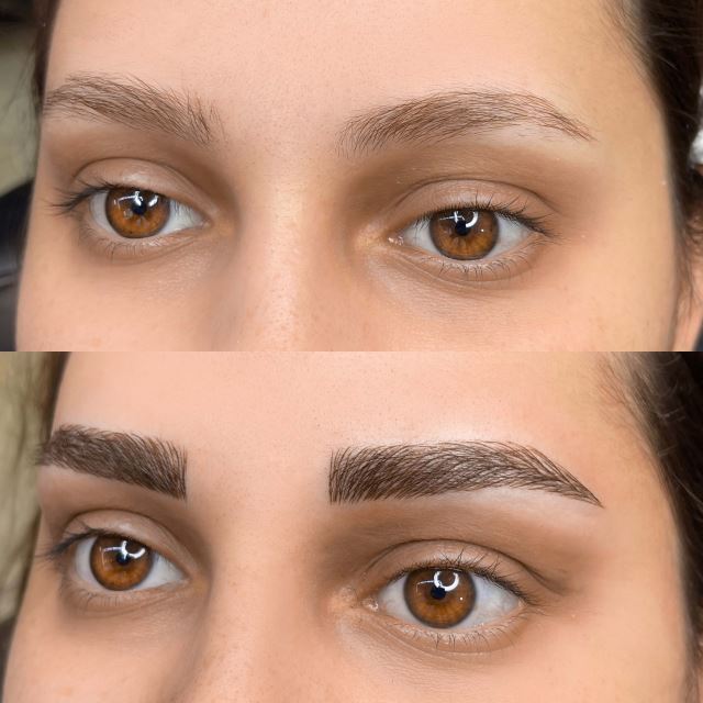 میکروبلیدینگ