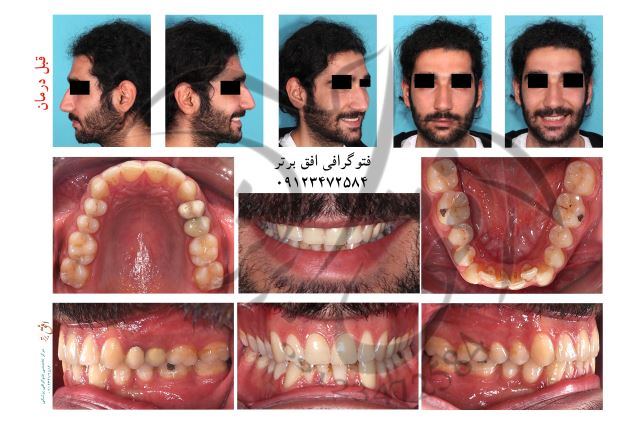 عکسای ارتودنسی