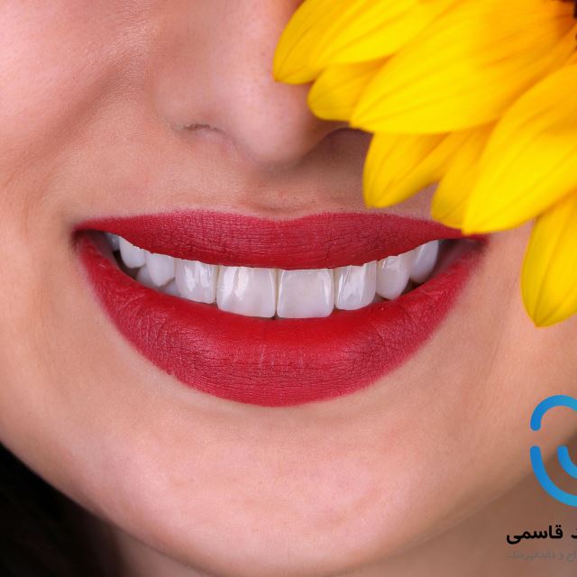 عکسهای لمینت و کامپوزیت بعد درمان