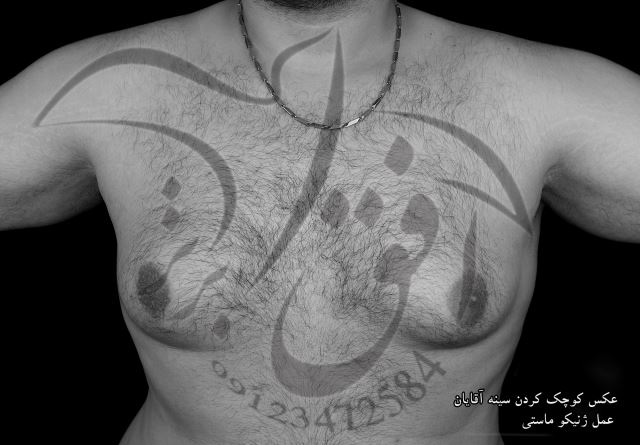 عکس عمل سینه