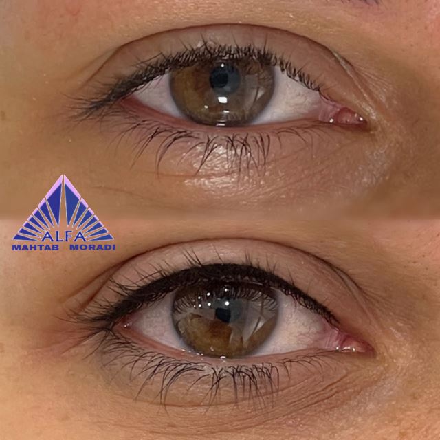 بنمژه (خط مژه)