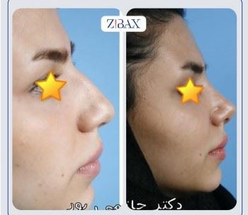 بهترین جراح بینی در شیراز