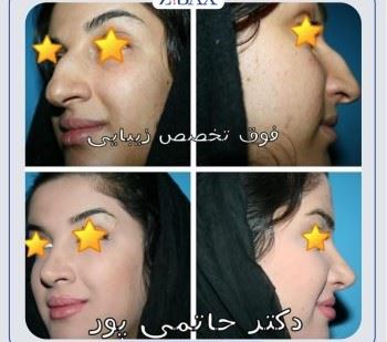 بهترین جراح بینی در شیراز