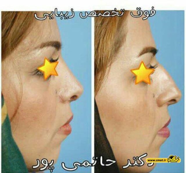 بهترین جراح بینی در شیراز