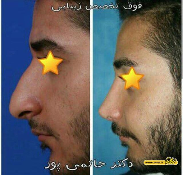 بهترین جراح بینی در شیراز
