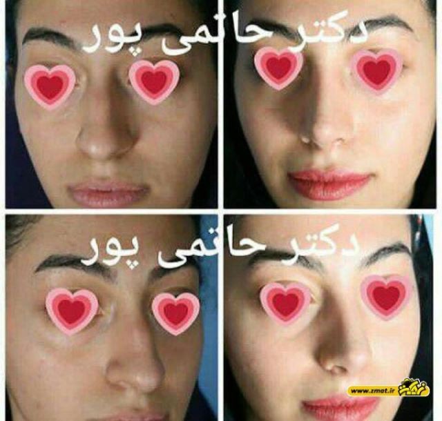 بهترین جراح بینی در شیراز