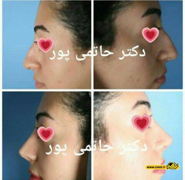 بهترین جراح بینی در شیراز