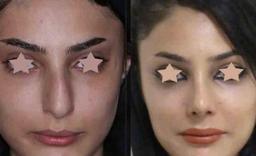 بهترین جراح بینی در شیراز