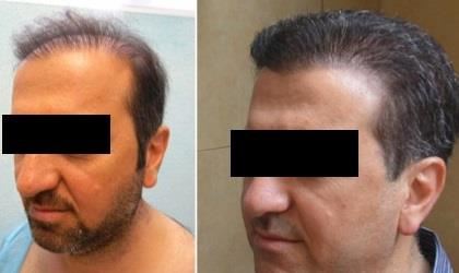 بهترین جراح بینی در شیراز