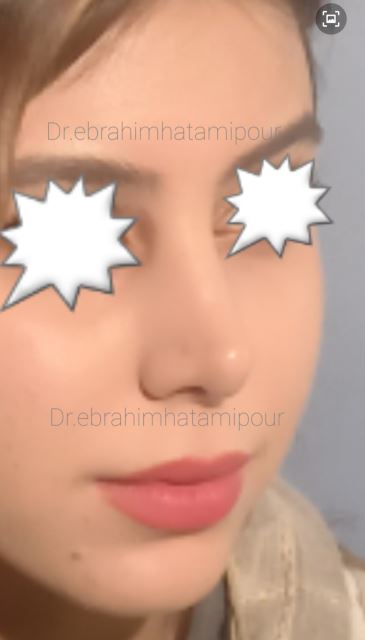 بهترین جراح بینی در شیراز