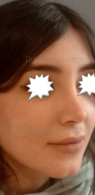 بهترین جراح بینی در شیراز