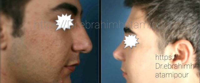 بهترین جراح بینی در شیراز
