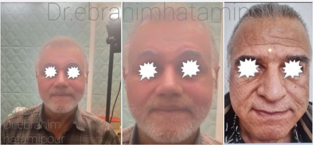 بهترین جراح بینی در شیراز