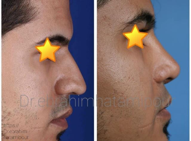 بهترین جراح بینی در شیراز