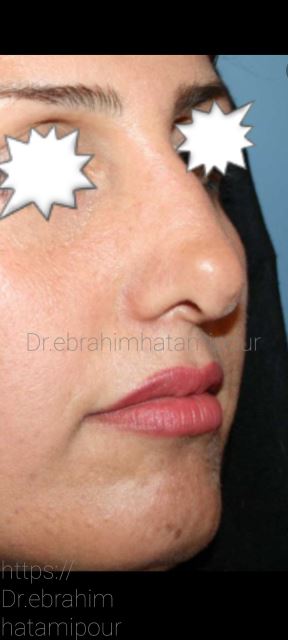 بهترین جراح بینی در شیراز