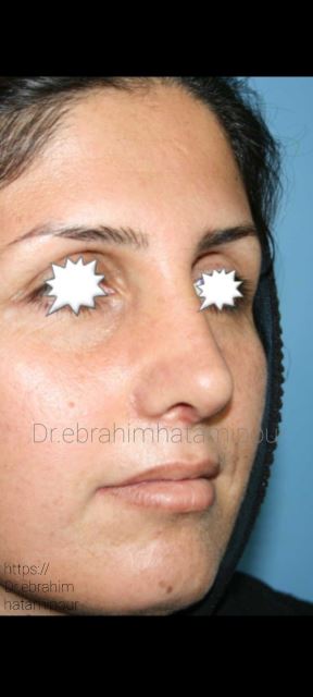 بهترین جراح بینی در شیراز