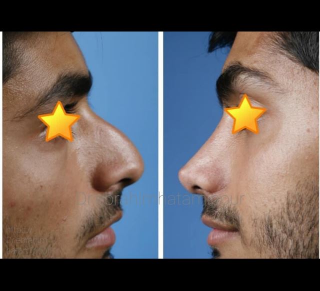 بهترین جراح بینی در شیراز