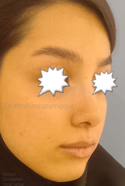 بهترین جراح بینی در شیراز