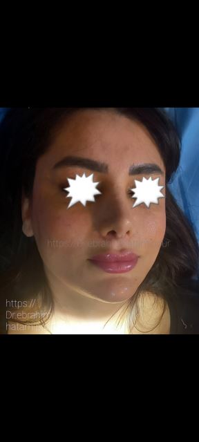 بهترین جراح بینی در شیراز