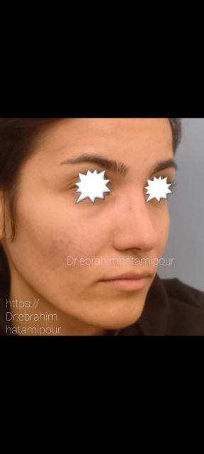 بهترین جراح بینی در شیراز