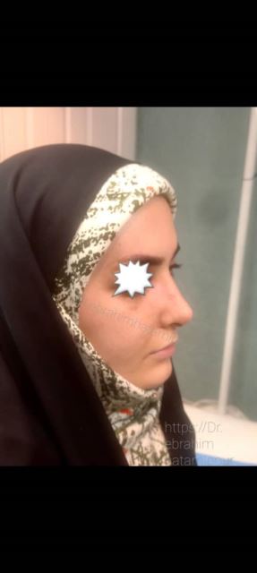 بهترین جراح بینی در شیراز