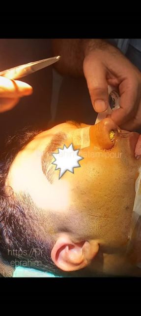 بهترین جراح بینی در شیراز