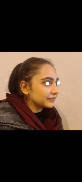 بهترین جراح بینی در شیراز