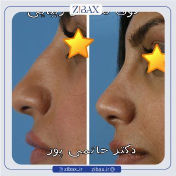 بهترین جراح بینی در شیراز