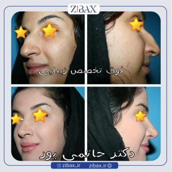 بهترین جراح بینی در شیراز