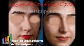بهترین جراح بینی در شیراز