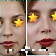 بهترین جراح بینی در شیراز